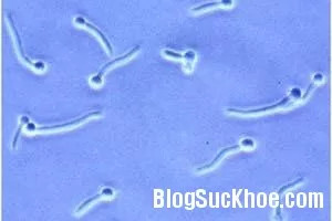 Nấm Candida sinh dục - Bệnh có thể phòng