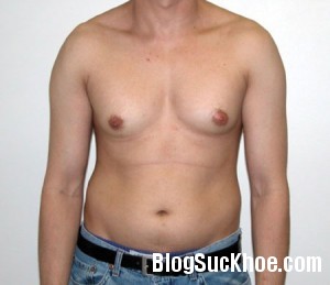 nam2 Nguyên nhân và biểu hiện phì đại tuyến vú ở nam giới