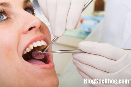 rang3 Cách điều trị và tai biến khi mọc răng khôn