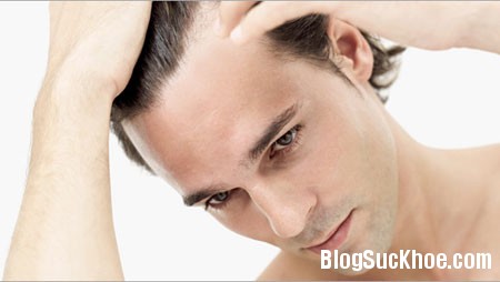 toc Nguyên nhân khiến nam giới bị rụng tóc