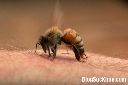 ong Nọc ong   Vị thuốc quý chữa bệnh