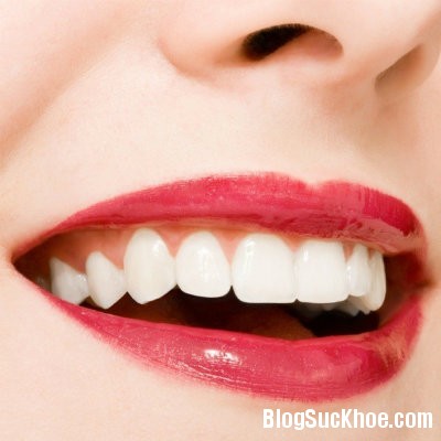 rang3 Dấu hiệu nhận biết răng bị lão hóa