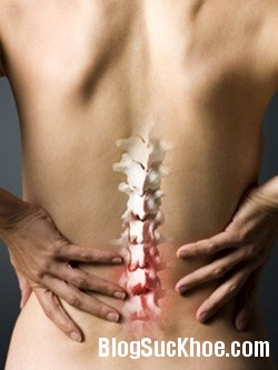  Triệu chứng và cách chữa bệnh đau cột sống lưng