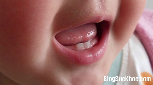 1196 Những bệnh ở miệng thường gặp ở trẻ