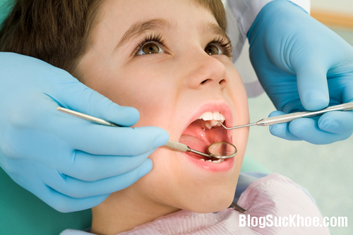 14 Những bệnh ở miệng thường gặp ở trẻ