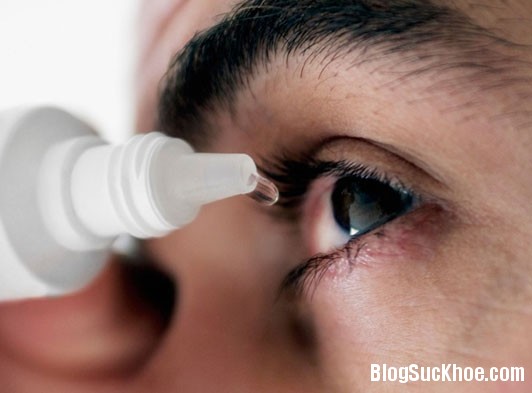 1425 Những điều cần biết về bệnh đau mắt đỏ