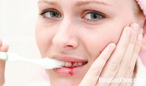 1152 Chảy máu chân răng   nguy cơ đối mặt với bệnh nguy hiểm