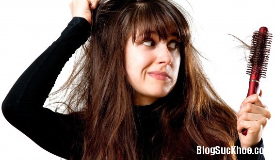 1296 Rụng tóc thường xuyên   dấu hiệu cảnh báo bệnh nguy hiểm