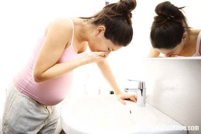 1 176 Mẹo khắc phục tình trạng buồn nôn khi mang thai