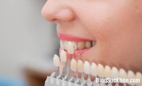 1 260 Mẹo giúp hạn chế khó chịu sau khi làm trắng răng