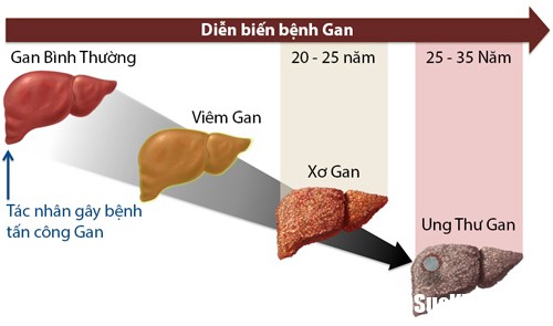 2 1501087399268 Bí quyết để có một lá gan khoẻ mạnh