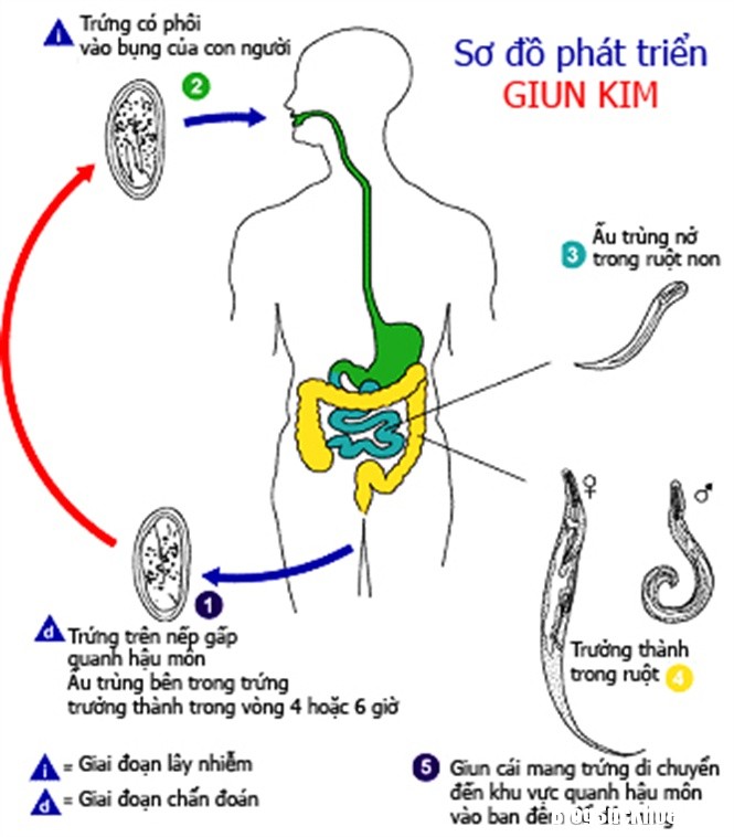 Phong tri giun dua giun kim 1 Cách phòng trị giun đũa, giun kim hiệu quả