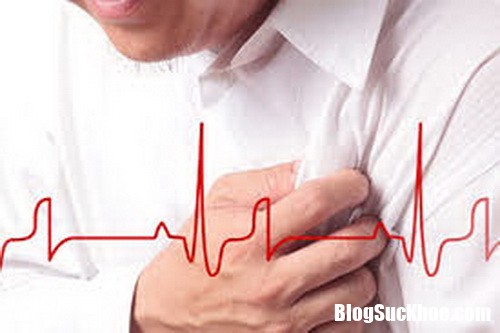 phan bit cn au tim va t qu resize Đột quỵ và cơn đau tim khác nhau thế nào ?