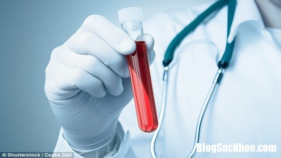 xet nghiem mau  Chỉ một lần xét nghiệm máu phát hiện được ngay 13 bệnh