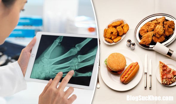 xương khớp Thực phẩm chứa axit béo có thể là nguyên nhân gây bệnh xương khớp