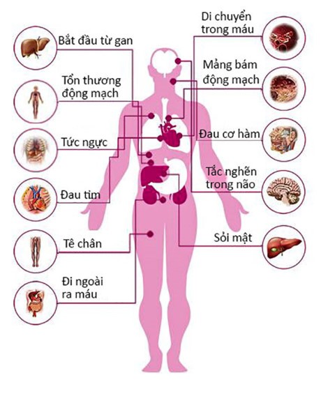 1 158570 Cholesterol cao nguy hiểm như thế nào?