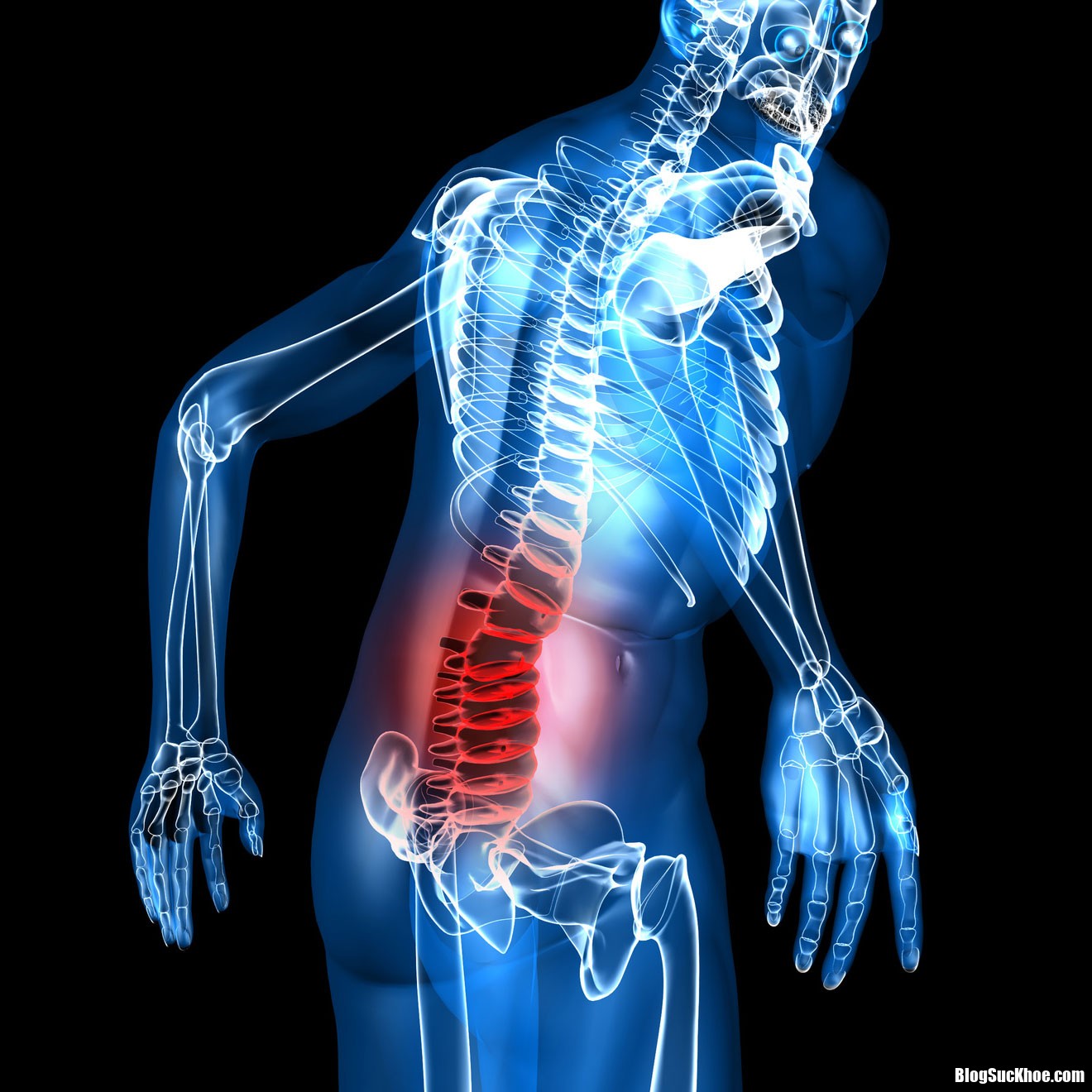 Dau lung tu nao 1 Nguyên nhân gây đau lưng xuất phát từ não