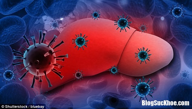 viêmgan vrius Viêm gan virus là nguyên nhân gây tử vong nhiều hơn cả HIV nhưng lại ít được quan tâm