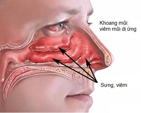 171636 nuoc nong Mùa thu đông uống nước nóng thu về vô số lợi ích cho sức khỏe