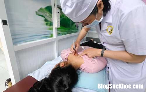 CheTrung PP Nhi Cham Thuy Cham 2383 4815 1502599404 Phương pháp thủy châm điều trị hiệu quả bệnh đau vai gáy
