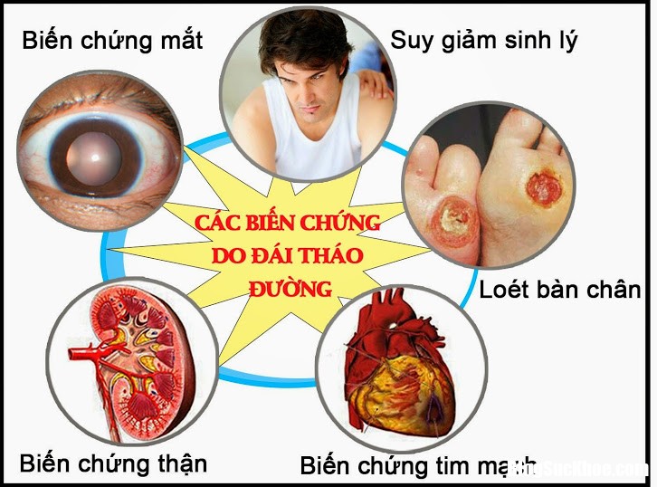 ba buoc de loai bo can benh dai thao duong1 Những dấu hiệu báo động biến chứng của tiểu đường