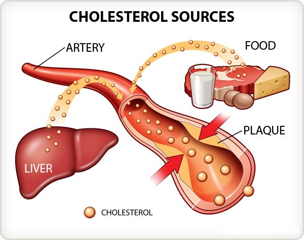 cholesterol2 Chế độ ăn uống hợp lý cho người bị cholesterol cao