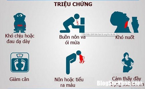 yo su687 Ba căn bệnh ung thư phổ biến thường gặp ở đàn ông Việt Nam