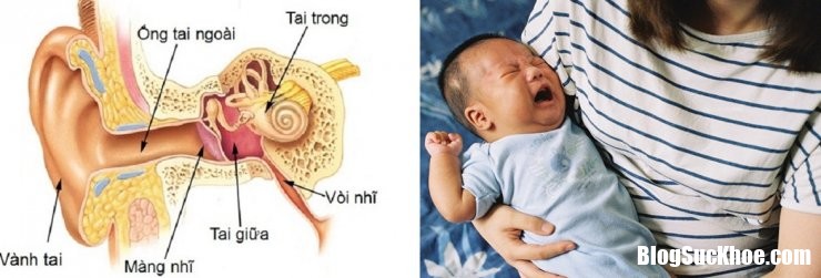 be khoc 1701 Tìm hiểu những thông tin giúp bé tránh xa bệnh viêm tai giữa