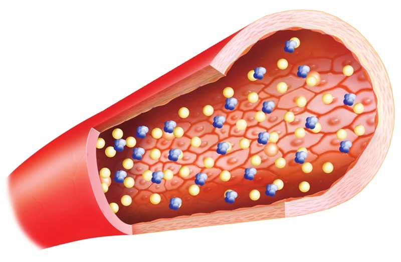 calcium động mạch 1 Tồn đọng canxi trong động mạch có nguy cơ tử vong cao