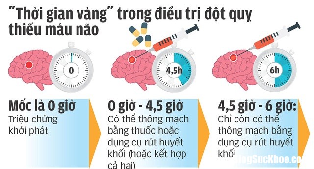 gio vang de cuu dot quy 29 .6577 Cứu đột quỵ cần lưu ý đến giờ vàng