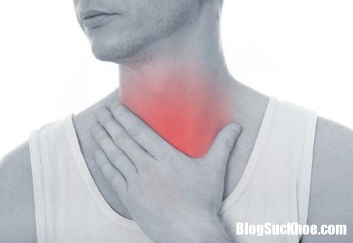sore throat causing snoring 111129170 Cẩn thận triệu chứng của ung thư nếu nuốt nước bọt nghe hôi