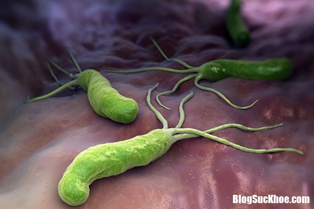vi khuan helicobacter pylori Triệu chứng cho thấy dạ dày bị nhiễm vi khuẩn Hp