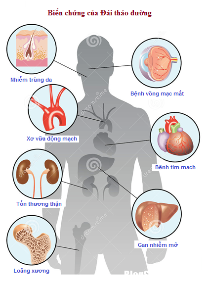 19327955298 0c7f507628 o Bệnh đái tháo đường và những biện pháp phòng ngừa biến chứng
