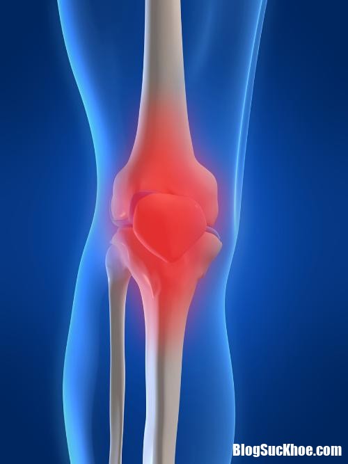 knee pain 31101046 Những triệu chứng nhận biết bệnh loãng xương