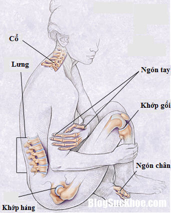 thk2 Những thông tin bổ ích về bệnh thoái hóa khớp