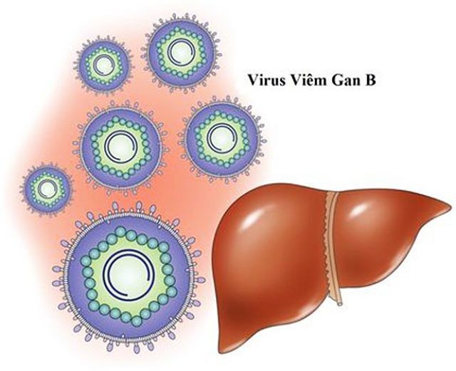 benh viem gan b2 Bệnh viêm gan B và những triệu chứng cơ bản nhất