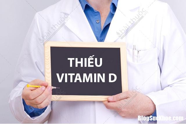 5 benh thuong gap do thieu vitamin d 241513536 Thiếu vitamin D dễ gây ra 5 căn bệnh này