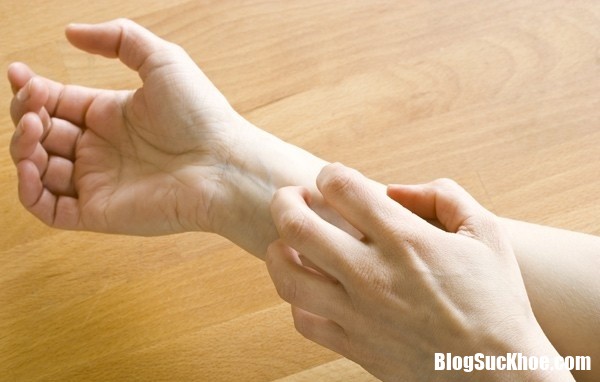 cach giam ngua nhanh chong khi bi eczema viem da cham11521172226 Bí quyết giúp giảm ngứa cho người bị eczema