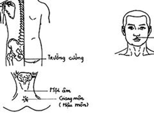 180755 thuong ma phong Đừng chết vì thiếu hiểu biết về căn bệnh thuuwongj mã phong!