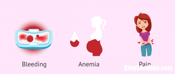 1 uterine polyps causes symptoms treatment 135638405 Polyp tử cung là bệnh gì? Ngăn chặn và điều trị như thế nào?