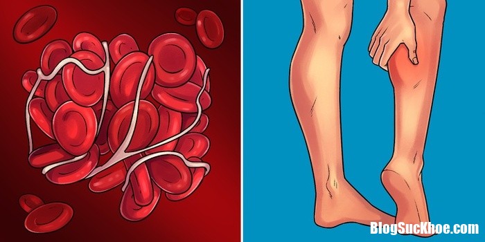 10 early signs that can help you identify serious diseases in time 133341558 Dấu hiệu nhận biết 10 bệnh nguy hiểm và phổ biến nhất hiện nay