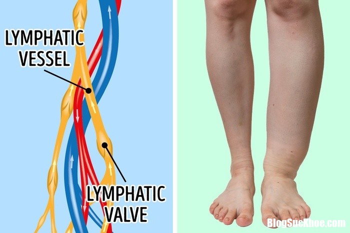 5 things your swollen feet and ankles are trying to tell you about your health 141248738 Bàn chân sưng lên là dấu hiệu các bệnh tim mạch