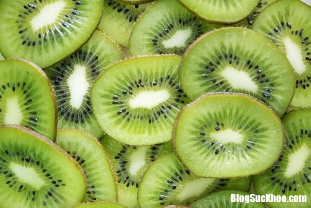 kiwi Những dấu hiệu cảnh báo về tai biến mạch máu não cần cảnh giác