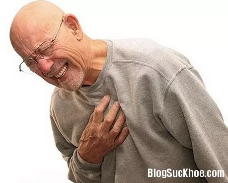 Cảnh báo các dấu hiệu đột quỵ