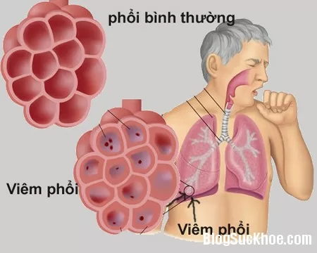 phoi