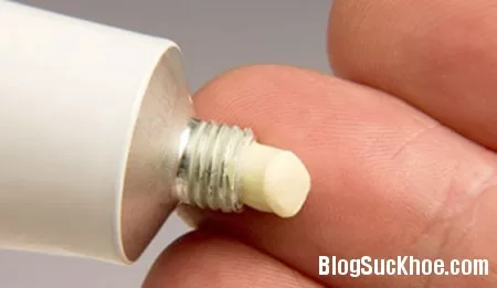 Hạn chế lạm dụng corticoid