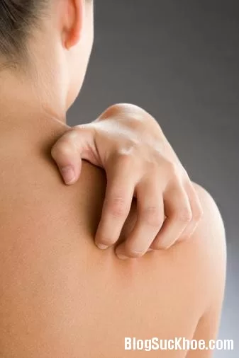 Điều trị triệt để bệnh ghẻ ngứa