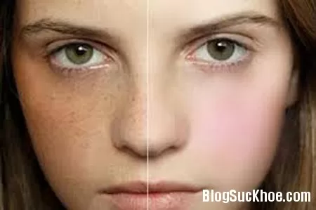 7 dấu hiệu cho thấy da đang bị hư tổn và cách để có làn da khỏe mạnh