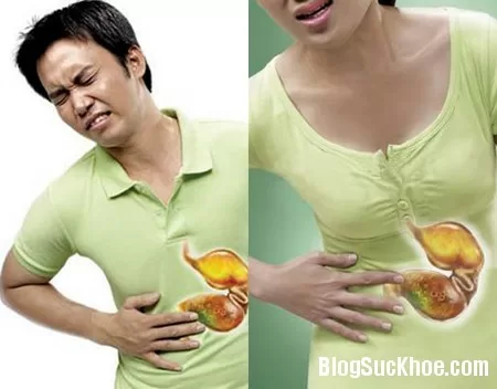 Nguyên nhân và triệu chứng bệnh đau dạ dày