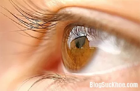 Nguyên nhân và triệu chứng của viễn thị